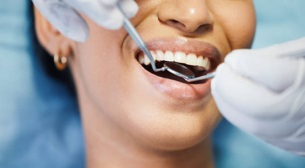 Best Orthodontic Emergency Dentist in Connerton, FL