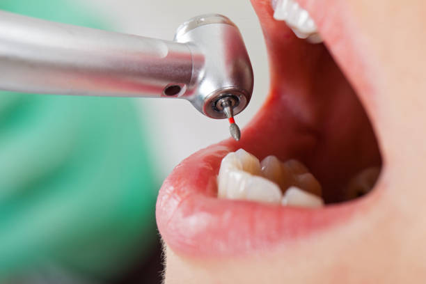 Best Pediatric Emergency Dentist in Connerton, FL